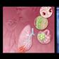 Virus RSV - Nguyên nhân gây bệnh viêm phổi ở trẻ em